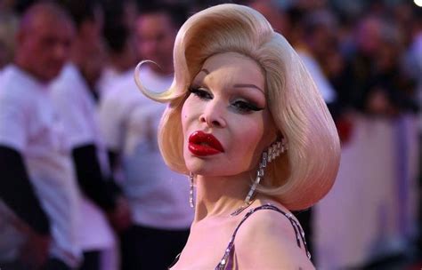 Celebrities Who Look Worse After Plastic Surgery Plastic Surgery Gone Wrong Amanda Lepore