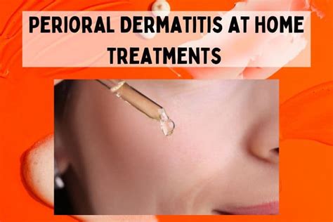 Perioral Dermatitis Self Care With Over The Counter Treatments