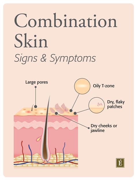 Combination Skin What It Is And How To Manage It Approx Cosmetics