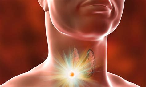 Throat Cancer Symptoms And Signs Are You At Risk Watch Out For A Sore Throat Health Life