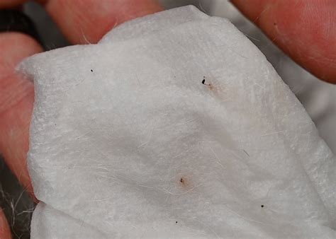 Flea Dirt On Sheets