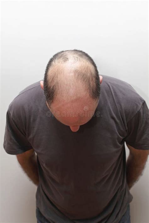 824 Bald Head Top Stock Photos Free And Royalty Free Stock Photos From