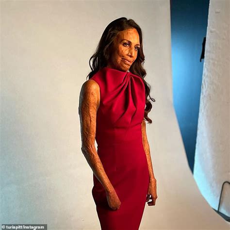 Inspirational Burns Survivor Turia Pitt Reveals How She Learned To Feel