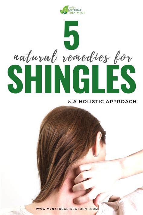 5 Natural Remedies For Shingles Natural Remedies Skin Remedies Remedies