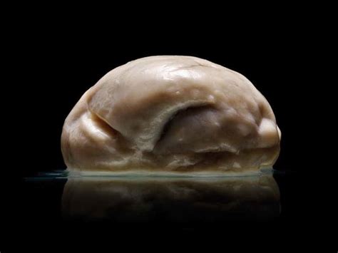 Is This The Most Extraordinary Human Brain Ever Seen New Scientist