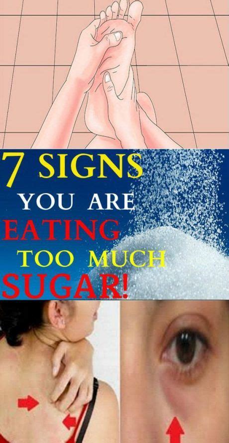 7 Signs You Are Eating Too Much Sugar And You Must Stop The