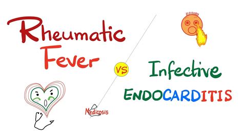 Rheumatic Fever Vs Infective Endocarditis Comparison Cardiology