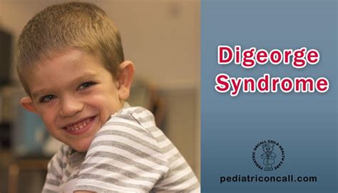 What Is Digeorge Syndrome And Symptoms Of Digeorge Syndrome Digeorge