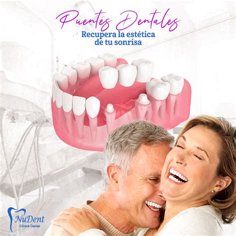 Estética Dental Clinica Nudent Trujillo Ortodoncia Implantes