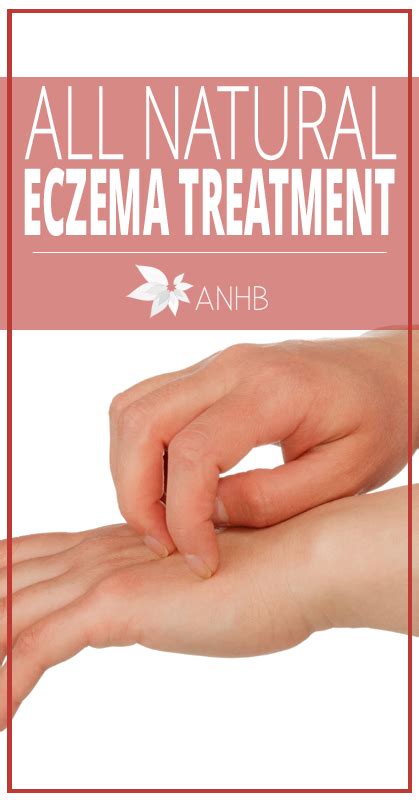 All Natural Eczema Treatment Updated For 2018