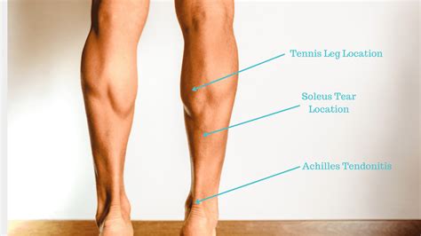 Calf Muscle Pain Causes Of Calf Muscle Pain Sore Calf Muscle