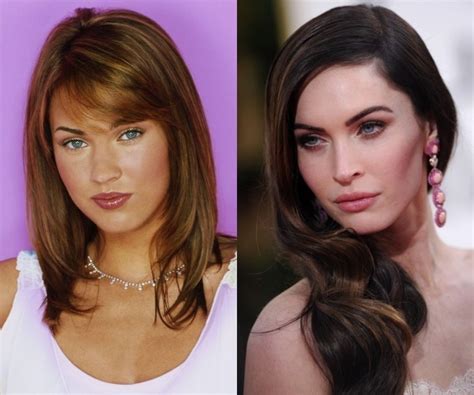 Plastic surgery procedures started as medical treatments but grew into cosmetic surgeries. Megan Fox Plastic Surgery Before and After Pictures 2014-2015