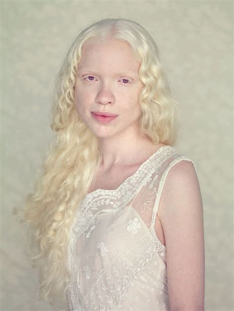 58 Albino People Wholl Mesmerize You With Their Otherworldly Beauty