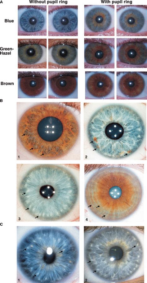 Eye Iris Has Flower Pattern Eveliza Tumisma