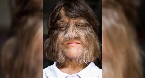 La mujer más peluda del mundo se afeita el rostro y sorprende con el