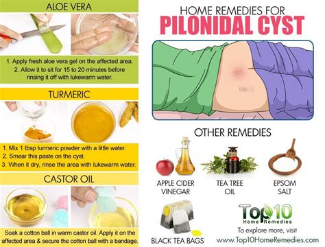 Home Remedies For Pilonidal Cysts Large Pimple At Bottom
