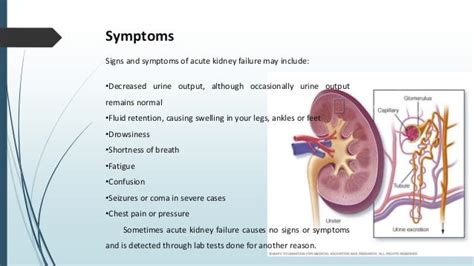 Acute Renal Failure Or Acute Kidney Injury