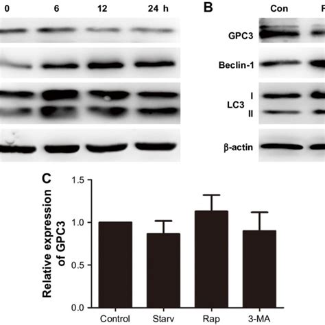 Autophagy Reduced Gpc3 Protein Level Notes A Expression Of Gpc3 In