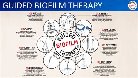 What Is Guided Biofilm Therapy L London Hygienist