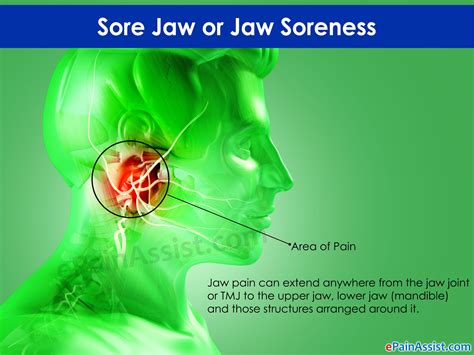 Pin By Heather Callaway On Chronic Pain Sore Jaw Soreness Jaw Pain