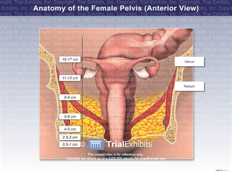 Find the perfect female pelvic anatomy stock photos and editorial news pictures from getty browse 203 female pelvic anatomy stock photos and images available, or start a new search to explore. Anatomy of the Female Pelvis (Anterior View) | Trial Exhibits, Inc.