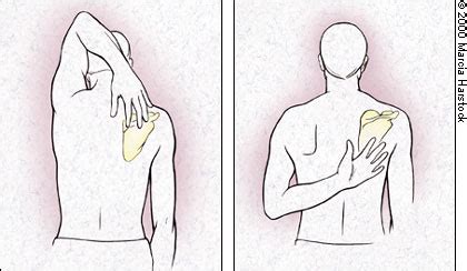 This shoulder external and shoulder internal rotation exercise has a lot of benefits, so let's give it a go. The Painful Shoulder: Part I. Clinical Evaluation ...