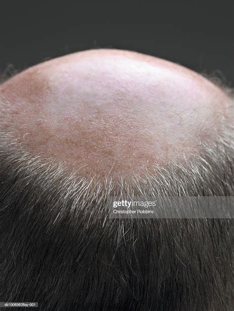 Balding Senior Man Rear View Closeup Of Top Of Head Stock Foto Getty