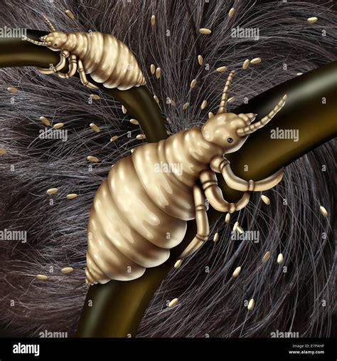Lice In Hair Problem As A Medical Concept With A Macro Close Up Of A Human Head With An