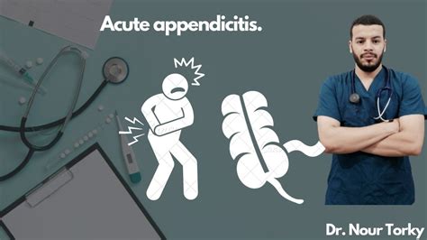 8 Acute Appendicitis Youtube