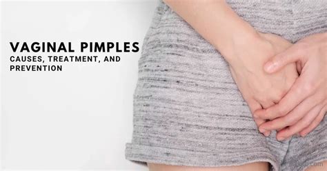 Vaginal Pimples Causes Treatment Prevention