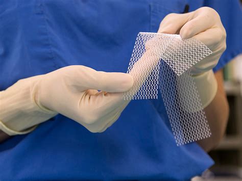 Vaginal Mesh New Material Which Avoids Serious Injuries And Side