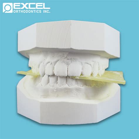 Study Models Excel Orthodontics