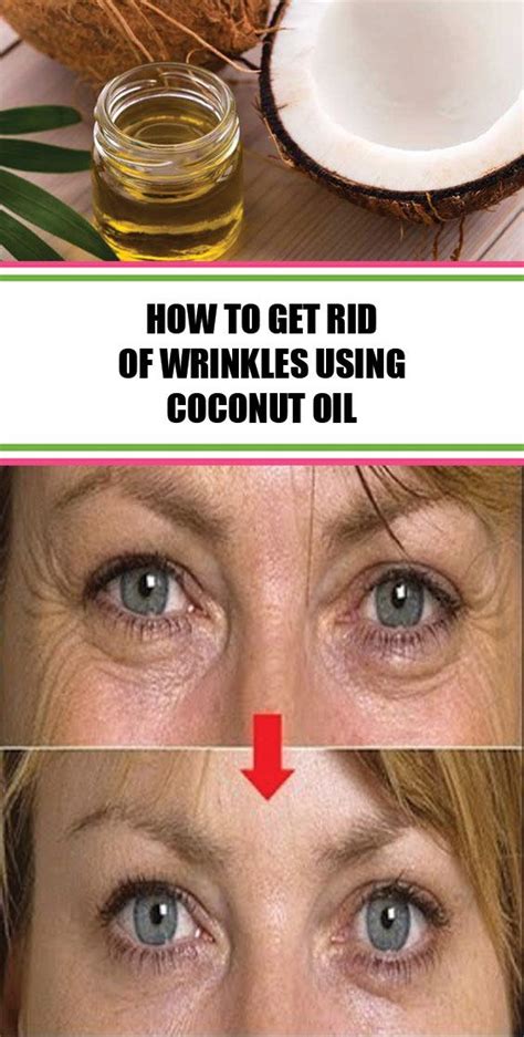 How To Get Rid Of Wrinkles Using Coconut Oil Beautytips Coconutoil