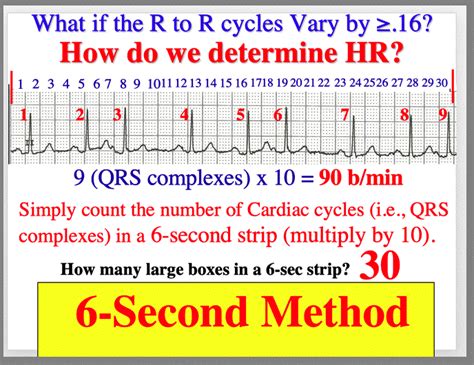 Six Second Heart Rate Method