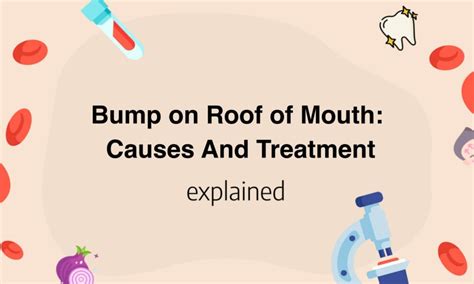 bump on roof of mouth causes and treatment