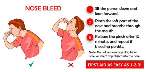 How To Treat And Prevent Nosebleeds Shoensafety Llc