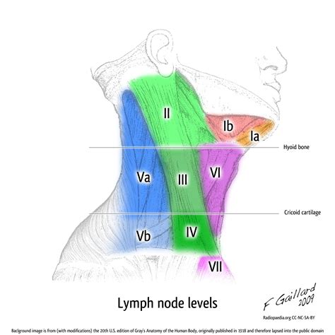 Lymph Node Levels Image
