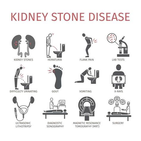 Kidney Stone Symptoms 7 Signs And Symptoms Of Kidney Stones