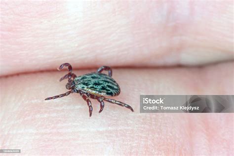 Lyme Diseasecarrier Ixodes Tick Dermacentor Marginatus On Human Skin