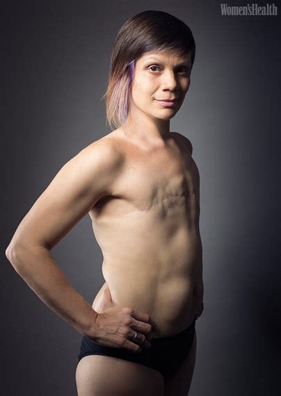 Women Show The Reality Of Their Mastectomies In Stunning Photos