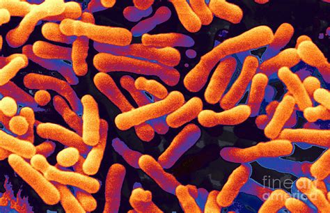 Bifidobacterium Animalis 4 Photograph By Scimat Fine Art America