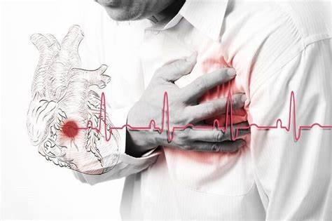 ишемическая болезнь | Causes of heart attack, Heart attack, Critical Картинка - ишемическая болезнь | Causes of heart attack, Heart attack, Critical