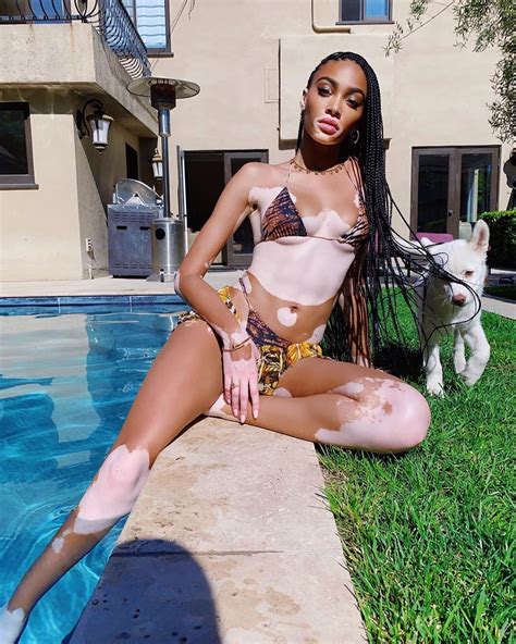 winnie harlow poses in a tiny bikini for sexy selfies 8 photos video the fappening