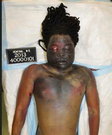 Kendrick Johnson: New autopsy in 'gym mat death' disputes ...