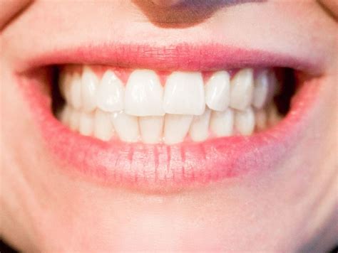 Gum Disease And How It Affects Your Health Smile Pad