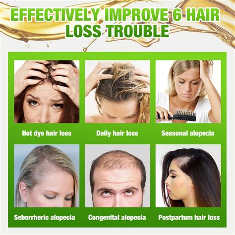 3010ml Ginger Fast Hair Growth Oil Hair Loss Treatment Scalp Repair