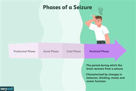 The Postictal Phase Of A Seizure