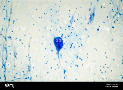 Micrografía De Luz Del Tejido Cerebral Humano Que Muestra Las Neuronas