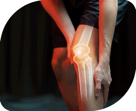 Acl Pain Treatment Kochi Acl Knee Surgery Cost Cochin