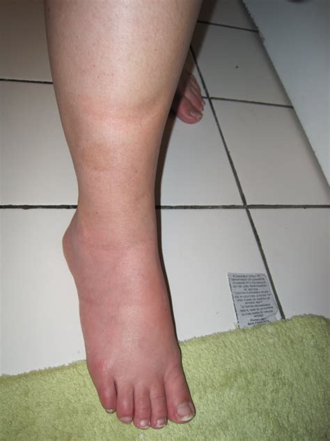 The Good Life: CANKLES